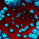 Study: CBD May Hold Potential to Kill Superbug Causing Staph Infections CBD-Staph-treatment-CBDToday